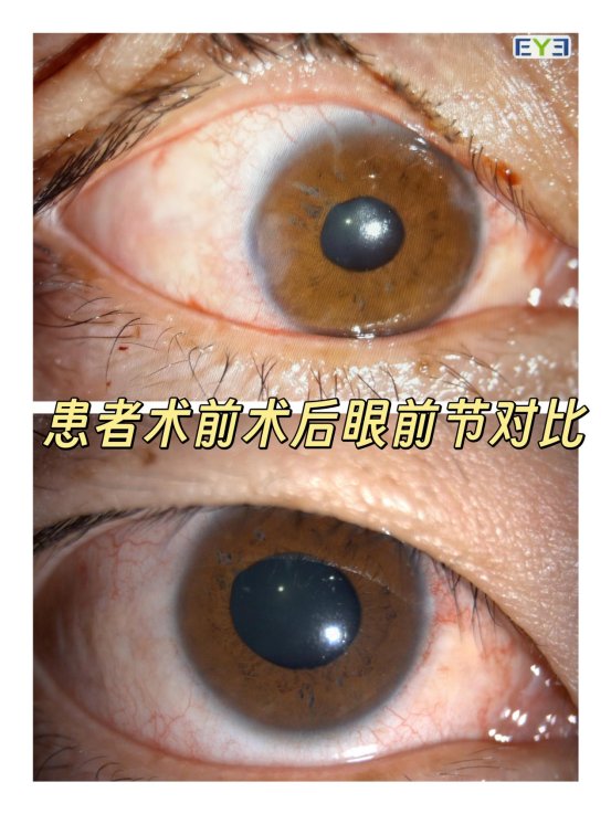患者