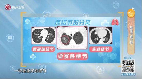 结节